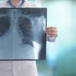 Una nueva prueba podría acelerar drásticamente el diagnóstico de infecciones pulmonares difíciles de detectar