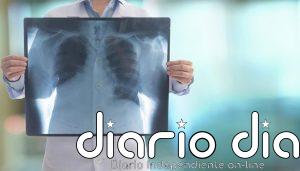 Una nueva prueba podría acelerar drásticamente el diagnóstico de infecciones pulmonares difíciles de detectar