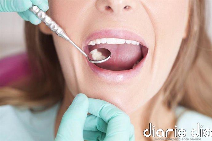 Células madre de la pulpa dental, ¿futura terapia para recuperar un ictus?