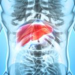 Dos estudios identifican las pruebas que pueden detectar la enfermedad hepática avanzada sin necesidad de biopsia