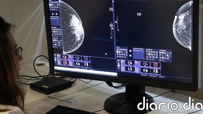 Fundación Rioja Salud incorpora un nuevo mamógrafo en la Unidad de Mama para mejor diagnóstico y detección precoz