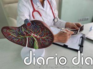 La Federación Española del Hígado (FEH) exige más inversión en ciencia y equidad para tratamientos en cáncer de hígado
