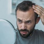 Tres de cada cuatro españoles han sufrido caída de cabello pero solo el 30% ha consultado con un profesional